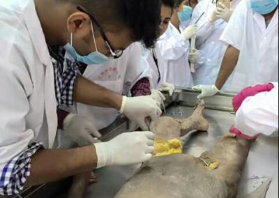body dissection